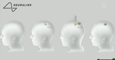 chip neuralink