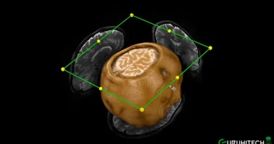 Iseult MRI