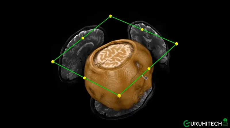 Iseult MRI