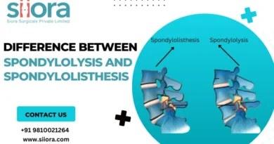 Spondylolysis