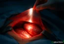 Chirurgia del futuro: il sangue diventa trasparente grazie all’intelligenza artificiale