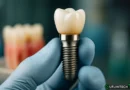 Il dente che sente e si rigenera: la rivoluzione bioingegneristica della Tufts University