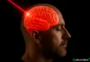 Scienza da fantascienza: un laser attraversa per la prima volta il cranio umano