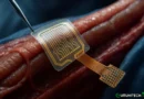 Una scossa che ridà la vita: l’impianto elettrico che può far camminare di nuovo