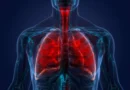 Pulmonology and Respiratory Health Solutions